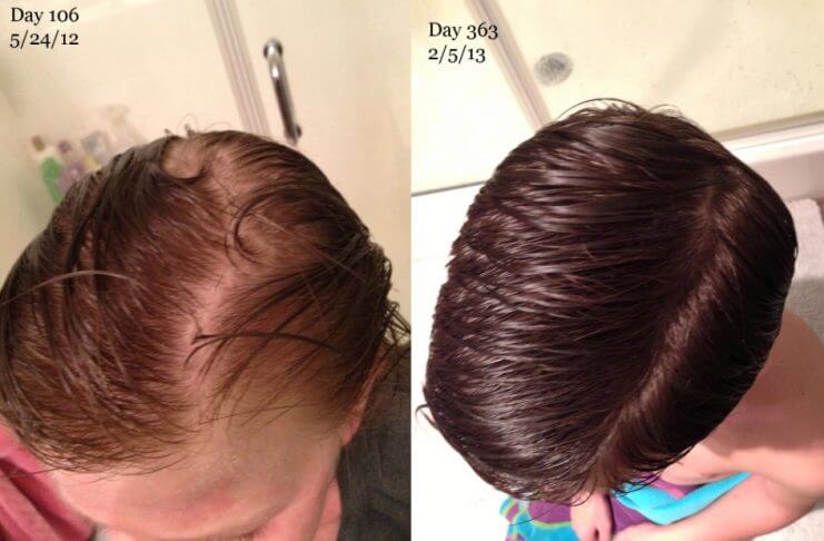 Najlepsze, domowe sposoby na zniszczone włosy