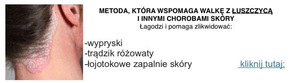 sposób na łuszczycę