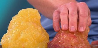 Ten brązowy tłuszcz zwalcza „trudny” tłuszcz i spala więcej kalorii-jak zrobić, aby było go więcej?