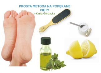 DOMOWY SPOSÓB NA POPĘKANE PIĘTY-REZULTAT NATYCHMIASTOWY!