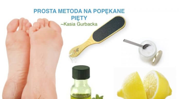 DOMOWY SPOSÓB NA POPĘKANE PIĘTY-REZULTAT NATYCHMIASTOWY!