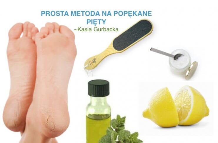 DOMOWY SPOSÓB NA POPĘKANE PIĘTY-REZULTAT NATYCHMIASTOWY!