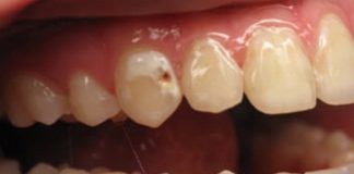 ZOBACZ CO SIĘ DZIEJE Z TWOIM CIAŁEM KIEDY PIJESZ GAZOWANE