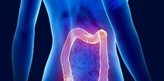 JAK WYLECZYĆ ZAPARCIA OCTEM JABŁKOWYM?