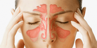 OCET JABŁKOWY NA ZATOKI-JAK JE DOBRZE LECZYĆ?