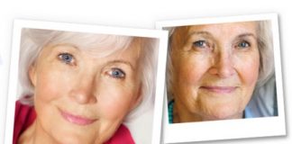 3 naturalne składniki, które mają działanie odmładzające