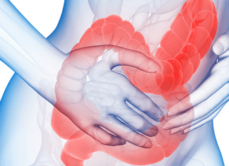 Zespół drażliwego jelita – czy to prawdziwa choroba?