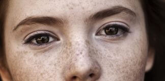 Skuteczne domowe sposoby na przebarwienia skóry