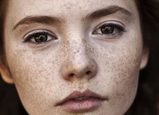 Skuteczne domowe sposoby na przebarwienia skóry