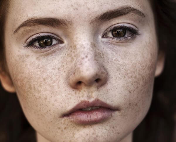 Skuteczne domowe sposoby na przebarwienia skóry