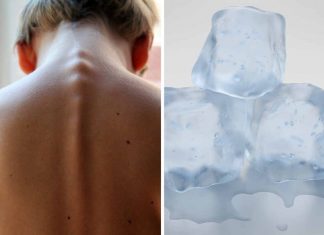Kuracja kostkami lodu – prosty sposób na pozbycie się dolegliwości kuracja lodem
