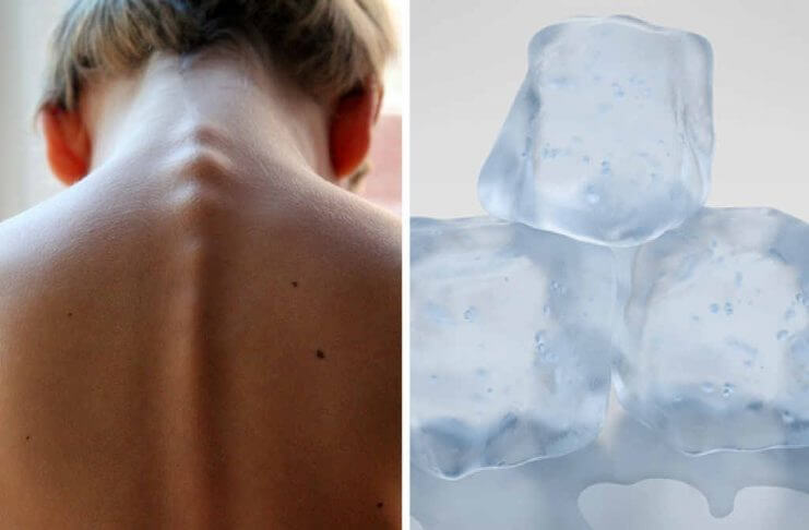 Kuracja kostkami lodu – prosty sposób na pozbycie się dolegliwości kuracja lodem