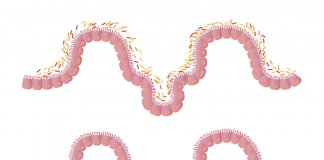 Prosty sposób na pozbycie się złogów i oczyszczenie jelit oczyszczanie organizmu