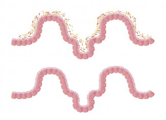 Prosty sposób na pozbycie się złogów i oczyszczenie jelit oczyszczanie organizmu