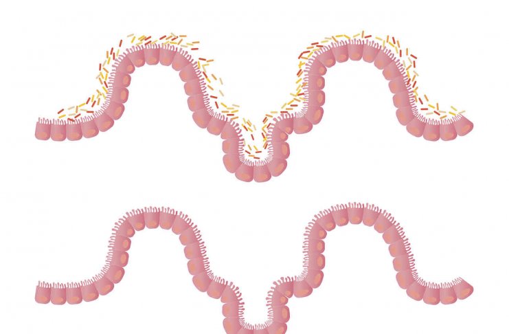 Prosty sposób na pozbycie się złogów i oczyszczenie jelit oczyszczanie organizmu