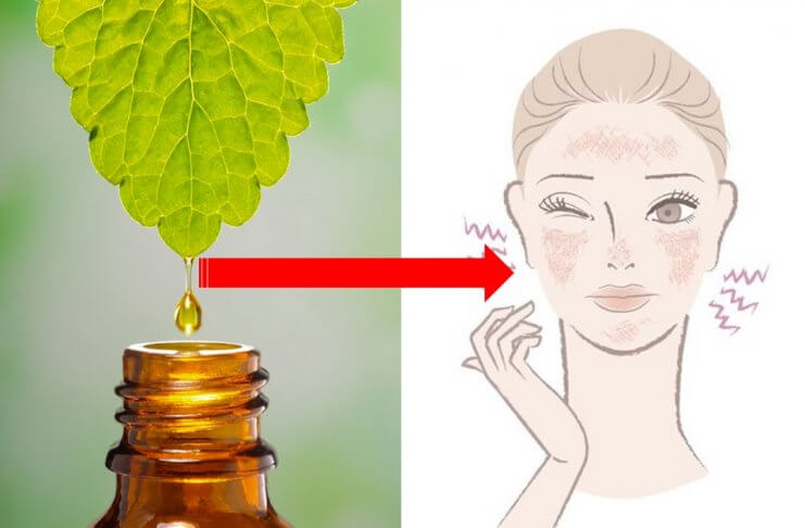 OLEJKI ETERYCZNE, KTÓRE ŁAGODZĄ PROBLEMY SKÓRNE olejki eteryczne na problemy skórne
