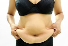 Sposoby, które pomogą pozbyć się nadmiaru luźnej skóry luźna skóra