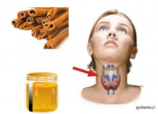 12 problemów, w jakich pomoże mieszanka miodu i cynamonu