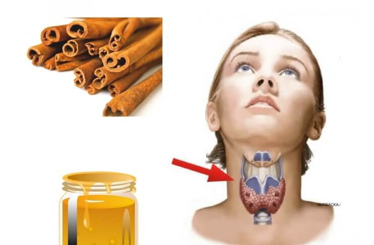 12 problemów, w jakich pomoże mieszanka miodu i cynamonu