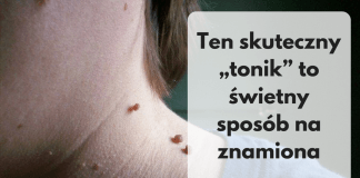 Szybki, prosty i tani sposób na znamiona