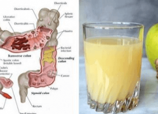 Mieszanka tych 5 prostych składników na oczyszczanie jelit