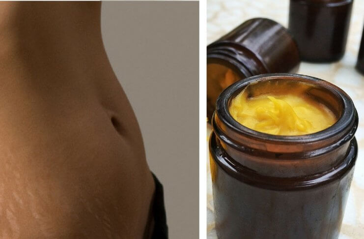 Domowa maść rozgrzewająca, która postawi Cię na nogi!