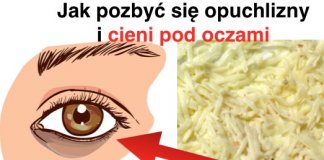 10 DOMOWYCH SPOSOBÓW NA POZBYCIE SIĘ OBRZĘKÓW POD OCZAMI