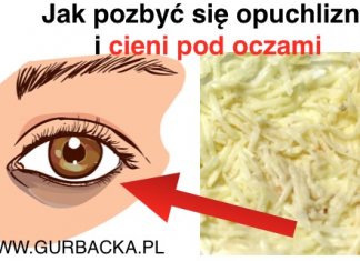 10 DOMOWYCH SPOSOBÓW NA POZBYCIE SIĘ OBRZĘKÓW POD OCZAMI