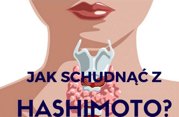 MASZ PROBLEMY Z TARCZYCĄ I NIE MOŻESZ SCHUDNĄĆ? POZNAJ PRZYCZYNY problemy z tarczycą