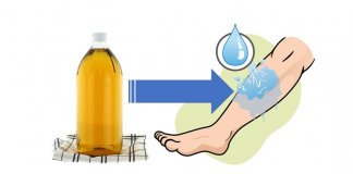 OBRZĘKI NÓG – OTO 10 DOMOWYCH SPOSOBÓW, JAK SIĘ ICH POZBYĆ obrzęki nóg ocet jabłkowy