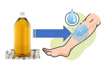 OBRZĘKI NÓG – OTO 10 DOMOWYCH SPOSOBÓW, JAK SIĘ ICH POZBYĆ obrzęki nóg ocet jabłkowy