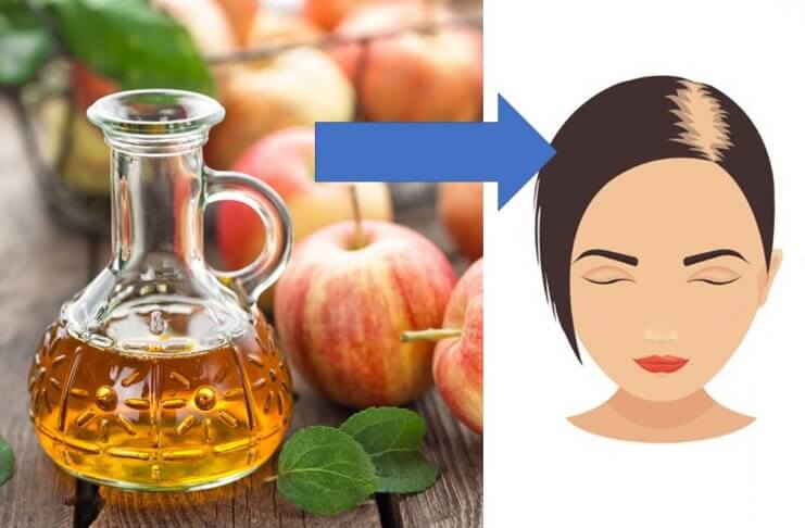 OCET JABŁKOWY NA WŁOSY. POZNAJ JEGO CZTERY ZALETY ocet jabłkowy na włosy