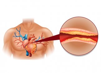 NATURALNE SPOSOBY NA OBNIŻENIE CHOLESTEROLU obniżenie cholesterolu