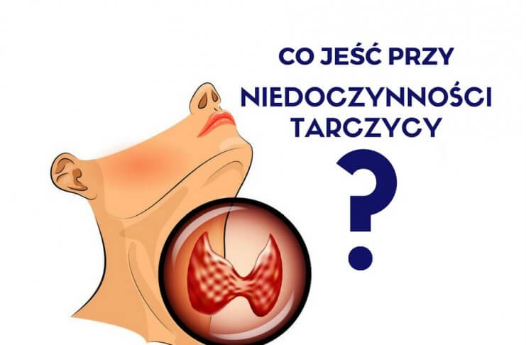 DIETA PRZY NIEDOCZYNNOŚCI TARCZYCY. CO JEŚĆ, A CZEGO UNIKAĆ?