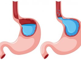 inhibitory pompy protonowej