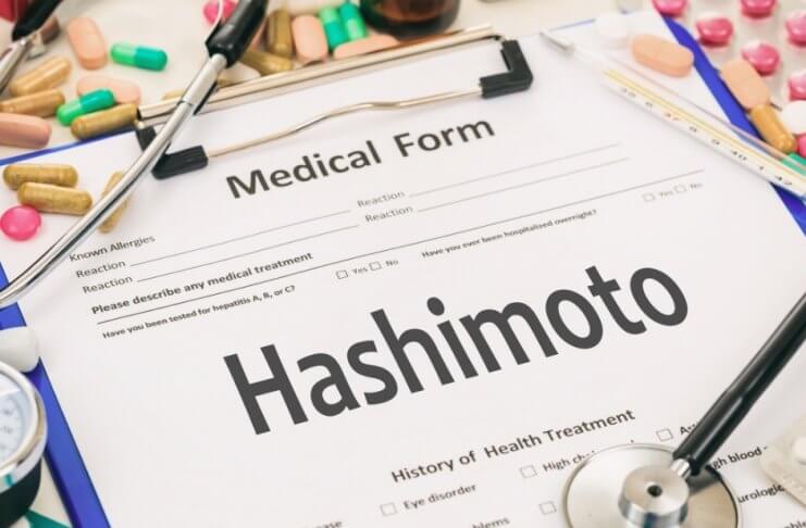 Zdrowa dieta w chorobie Hashimoto